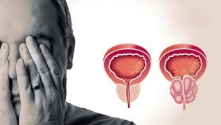 causas de prostatitis en hombres